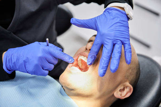 Best Teeth Whitening  in Ashburn, GA